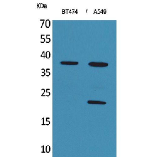 IFNA1 / Interferon Alpha 1 Antibody - Western blot of IFN-alpha1 antibody