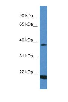 IFNA1 / Interferon Alpha 1 Antibody - IFNA13 / IFNA1 antibody Western blot of Placenta lysate. Antibody concentration 1 ug/ml.  This image was taken for the unconjugated form of this product. Other forms have not been tested.