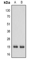 IFNA1 / Interferon Alpha 1 Antibody - Western blot analysis of IFN alpha 1 expression in MCF7 (A); A549 (B) whole cell lysates.