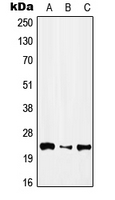 IFNA1 / Interferon Alpha 1 Antibody - Western blot analysis of IFN alpha 1 expression in HEK293T (A); NIH3T3 (B); H9C2 (C) whole cell lysates.