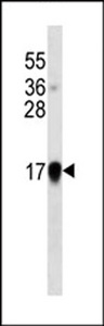 IFNA1 / Interferon Alpha 1 Antibody - Interferon-alpha western blot of IFN cell line lysates (35 ug/lane). The Interferon-alpha antibody detected the Interferon-alpha protein (arrow).