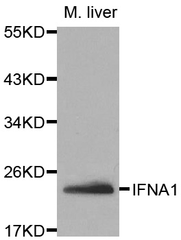 IFNA1 / Interferon Alpha 1 Antibody - Western blot analysis of extracts of mouse liver tissue, using IFNA1 antibody.
