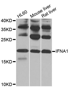 IFNA1 / Interferon Alpha 1 Antibody - Western blot analysis of extracts of various cell lines, using IFNA1 antibody at 1:1000 dilution. The secondary antibody used was an HRP Goat Anti-Rabbit IgG (H+L) at 1:10000 dilution. Lysates were loaded 25ug per lane and 3% nonfat dry milk in TBST was used for blocking. An ECL Kit was used for detection and the exposure time was 5s.