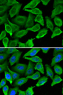 IFNA1 / Interferon Alpha 1 Antibody - Immunofluorescence analysis of A549 cells using IFNA1 antibody. Blue: DAPI for nuclear staining.