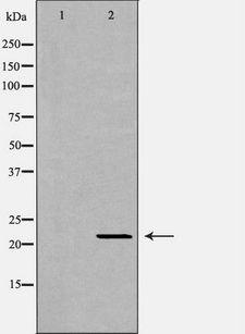 IFNA1 / Interferon Alpha 1 Antibody - Western blot analysis of extracts of mouse liver tissue using IFNA1 antibody. The lane on the left is treated with the antigen-specific peptide.