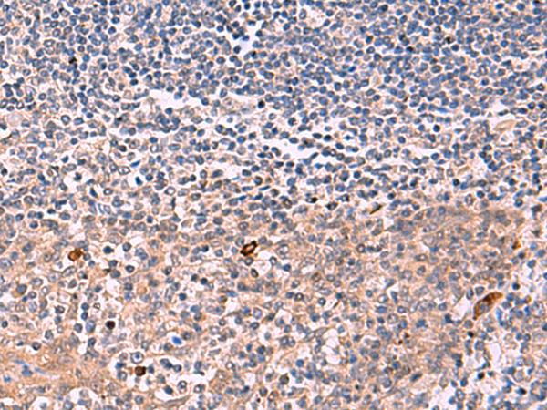 IFNA1 / Interferon Alpha 1 Antibody - Immunohistochemistry of paraffin-embedded Human tonsil tissue  using IFNA1:IFNA13 Polyclonal Antibody at dilution of 1:35(×200)