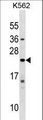 IFNA10 / Interferon Alpha 10 Antibody - IFNA10 Antibody western blot of K562 cell line lysates (35 ug/lane). The IFNA10 antibody detected the IFNA10 protein (arrow).