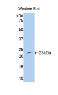 IFNA10 / Interferon Alpha 10 Antibody - Western blot of recombinant IFNA10.  This image was taken for the unconjugated form of this product. Other forms have not been tested.
