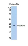 IFNA10 / Interferon Alpha 10 Antibody - Western blot of recombinant IFNA10.  This image was taken for the unconjugated form of this product. Other forms have not been tested.