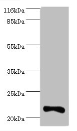IFNA10 / Interferon Alpha 10 Antibody - Western blot All lanes: Interferon alpha-10 antibody at 2µg/ml + Mouse kidney tissue Secondary Goat polyclonal to rabbit IgG at 1/10000 dilution Predicted band size: 22 kDa Observed band size: 22 kDa