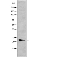 IFNA10 / Interferon Alpha 10 Antibody - Western blot analysis IFN10 using HeLa whole cells lysates