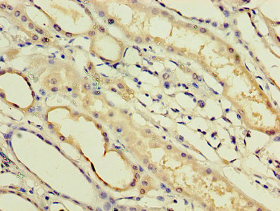 IFNA14 / Interferon Alpha 14 Antibody - Immunohistochemistry of paraffin-embedded human kidney tissue using IFNA14 Antibody at dilution of 1:100
