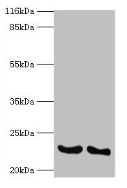 IFNA14 / Interferon Alpha 14 Antibody - Western blot All lanes: Interferon alpha-14 antibody at 2µg/ml Lane 1: A549 whole cell lysate Lane 2: Mouse lung tissue Secondary Goat polyclonal to rabbit IgG at 1/10000 dilution Predicted band size: 22 kDa Observed band size: 22 kDa