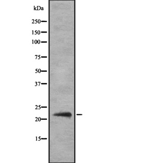 IFNA14 / Interferon Alpha 14 Antibody - Western blot analysis IFN14 using HeLa whole cells lysates