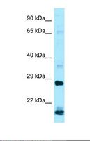 IFNA16 / Interferon Alpha 16 Antibody - Western blot of Human ACHN whole cell. IFNA16 antibody dilution 1.0 ug/ml.  This image was taken for the unconjugated form of this product. Other forms have not been tested.