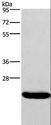 IFNA16 / Interferon Alpha 16 Antibody - Western blot analysis of Raji cell, using IFNA16 Polyclonal Antibody at dilution of 1:400.