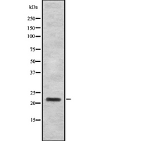 IFNA16 / Interferon Alpha 16 Antibody - Western blot analysis IFN16 using K562 whole cells lysates