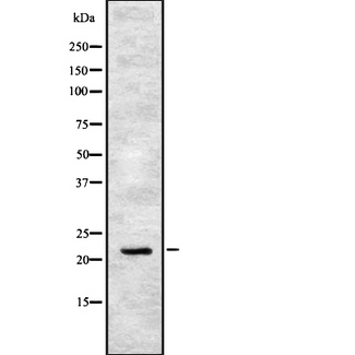 IFNA17 / Interferon Alpha 17 Antibody - Western blot analysis IFN17 using COLO205 whole cells lysates