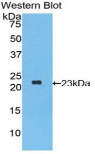 IFNA2 / Interferon Alpha 2 Antibody - Western blot of recombinant IFNA2 / Interferon Alpha 2.