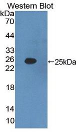 IFNA2 / Interferon Alpha 2 Antibody - Western blot of IFNA2 / Interferon Alpha 2 antibody.