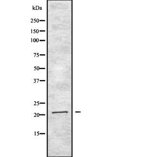IFNA2 / Interferon Alpha 2 Antibody - Western blot analysis of IFNA2 expression in HEK293 cells. The lane on the left is treated with the antigen-specific peptide.
