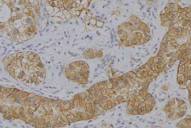 IFNA2 / Interferon Alpha 2 Antibody - 1:100 staining human uterus tissue by IHC-P. The sample was formaldehyde fixed and a heat mediated antigen retrieval step in citrate buffer was performed. The sample was then blocked and incubated with the antibody for 1.5 hours at 22°C. An HRP conjugated goat anti-rabbit antibody was used as the secondary.