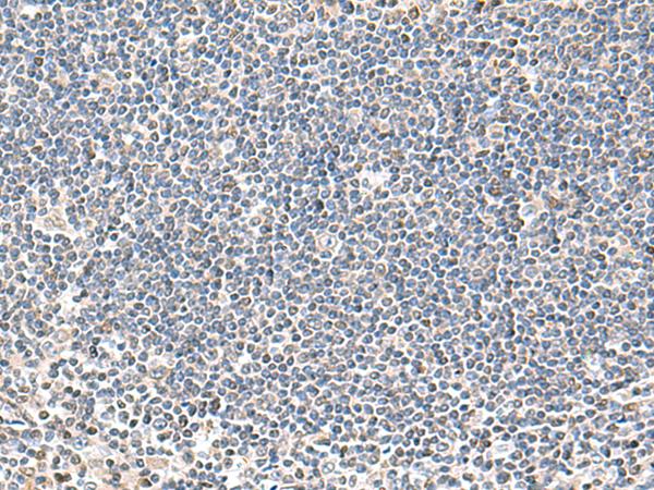 IFNA2 / Interferon Alpha 2 Antibody - Immunohistochemistry of paraffin-embedded Human tonsil tissue  using IFNA2 Polyclonal Antibody at dilution of 1:40(×200)