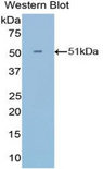 IFNA21 / Interferon Alpha 21 Antibody - Western blot of recombinant IFNA21.  This image was taken for the unconjugated form of this product. Other forms have not been tested.