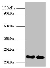 IFNA21 / Interferon Alpha 21 Antibody - Western blot All lanes: Interferon alpha-21 antibody at 2µg/ml Lane 1: NIH/3T3 whole cell lysate Lane 2: HepG2 whole cell lysate Secondary Goat polyclonal to rabbit IgG at 1/10000 dilution Predicted band size: 22 kDa Observed band size: 22 kDa