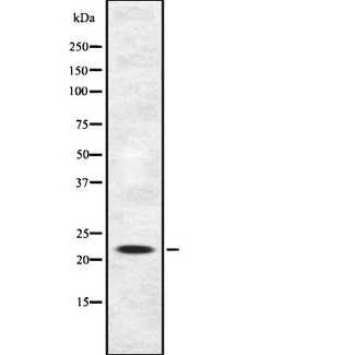 IFNA21 / Interferon Alpha 21 Antibody - Western blot analysis IFN21 using Jurkat whole cells lysates
