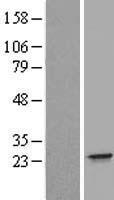 IFNA21 / Interferon Alpha 21 Protein - Western validation with an anti-DDK antibody * L: Control HEK293 lysate R: Over-expression lysate