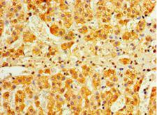 IFNA4 / Interferon Alpha 4 Antibody - Immunohistochemistry of paraffin-embedded human adrenal gland using antibody at 1:100 dilution.  This image was taken for the unconjugated form of this product. Other forms have not been tested.