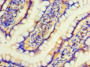 IFNA4 / Interferon Alpha 4 Antibody - Immunohistochemistry of paraffin-embedded human small intestine using antibody at 1: 100 dilution.  This image was taken for the unconjugated form of this product. Other forms have not been tested.