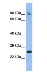 IFNA4 / Interferon Alpha 4 Antibody - IFNA4 / Interferon Alpha 4 antibody Western Blot of Fetal Stomach.  This image was taken for the unconjugated form of this product. Other forms have not been tested.