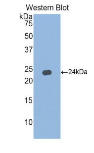 IFNA5 / Interferon Alpha 5 Antibody - Western blot of recombinant IFNA5 / Interferon Alpha 5.  This image was taken for the unconjugated form of this product. Other forms have not been tested.