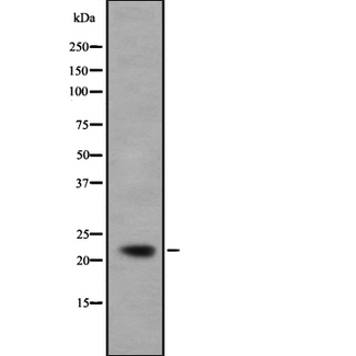 IFNA5 / Interferon Alpha 5 Antibody - Western blot analysis IFNA5 using COS7 whole cells lysates