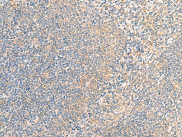IFNA5 / Interferon Alpha 5 Antibody - Immunohistochemistry of paraffin-embedded Human tonsil tissue  using IFNA5 Polyclonal Antibody at dilution of 1:35(×200)
