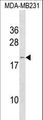 IFNA6 / Interferon Alpha 6 Antibody - IFNA6 Antibody western blot of MDA-MB231 cell line lysates (35 ug/lane). The IFNA6 antibody detected the IFNA6 protein (arrow).