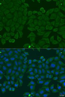 IFNA6 / Interferon Alpha 6 Antibody - Immunofluorescence analysis of U2OS cells using IFNA6 Polyclonal Antibody at dilution of 1:100.Blue: DAPI for nuclear staining.