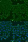 IFNA6 / Interferon Alpha 6 Antibody - Immunofluorescence analysis of U2OS cells using IFNA6 Polyclonal Antibody at dilution of 1:100.Blue: DAPI for nuclear staining.