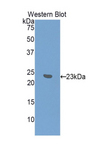 IFNA7 / Interferon Alpha 7 Antibody - Western blot of recombinant IFNA7 / Interferon Alpha 7.  This image was taken for the unconjugated form of this product. Other forms have not been tested.