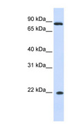 IFNA7 / Interferon Alpha 7 Antibody - IFNA7 antibody Western blot of Fetal liver lysate. This image was taken for the unconjugated form of this product. Other forms have not been tested.