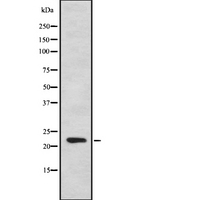 IFNA7 / Interferon Alpha 7 Antibody - Western blot analysis IFNA7 using HepG2 whole cells lysates