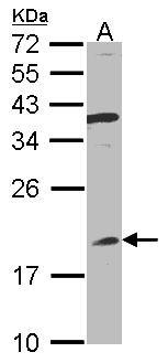 IFNA8 / Interferon Alpha 8 Antibody - Sample (30 ug whole cell lysate). A: Raji . 12% SDS PAGE. IFNA8 antibody diluted at 1:1000