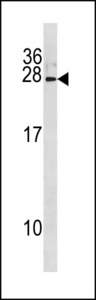 IFNA8 / Interferon Alpha 8 Antibody - IFNA8 Antibody western blot of NCI-H292 cell line lysates (35 ug/lane). The IFNA8 antibody detected the IFNA8 protein (arrow).