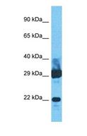 IFNA8 / Interferon Alpha 8 Antibody - Western blot of IFNA8 Antibody with human Fetal Liver lysate.  This image was taken for the unconjugated form of this product. Other forms have not been tested.