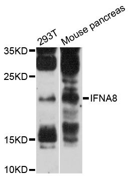 IFNA8 / Interferon Alpha 8 Antibody - Western blot analysis of extracts of various cell lines, using IFNA8 antibody at 1:3000 dilution. The secondary antibody used was an HRP Goat Anti-Rabbit IgG (H+L) at 1:10000 dilution. Lysates were loaded 25ug per lane and 3% nonfat dry milk in TBST was used for blocking. An ECL Kit was used for detection and the exposure time was 90s.