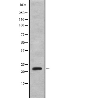 IFNA8 / Interferon Alpha 8 Antibody - Western blot analysis IFNA8 using K562 whole cells lysates