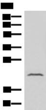 IFNA8 / Interferon Alpha 8 Antibody - Western blot analysis of Human fetal liver tissue lysate  using IFNA8 Polyclonal Antibody at dilution of 1:500