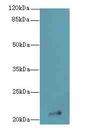 IFNAG Antibody - Western blot. All lanes: IFNAG antibody at 2 ug/ml+HL4- whole cell lysate Goat polyclonal to rabbit at 1:10000 dilution. Predicted band size: 22 kDa. Observed band size: 22 kDa.